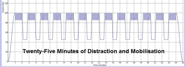 IDD Therapy 25 minute treatment graph
